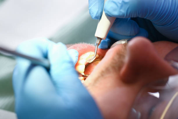 , WY Emergency Dentist Company