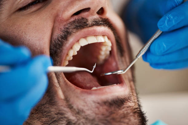 Best Same-Day Emergency Dental Services in Kemmerer, WY