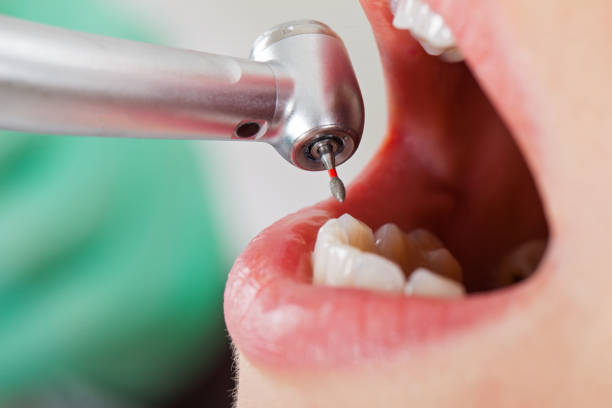 Best Emergency Orthodontic Services in Kemmerer, WY